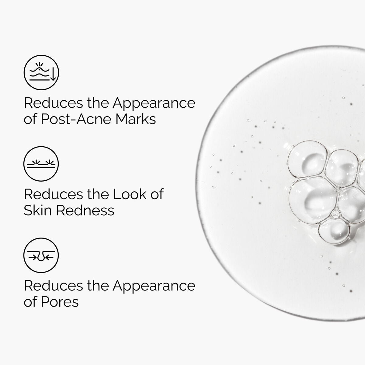 Soothing Aloe 2% and NAG 2% Post-Acne Solution