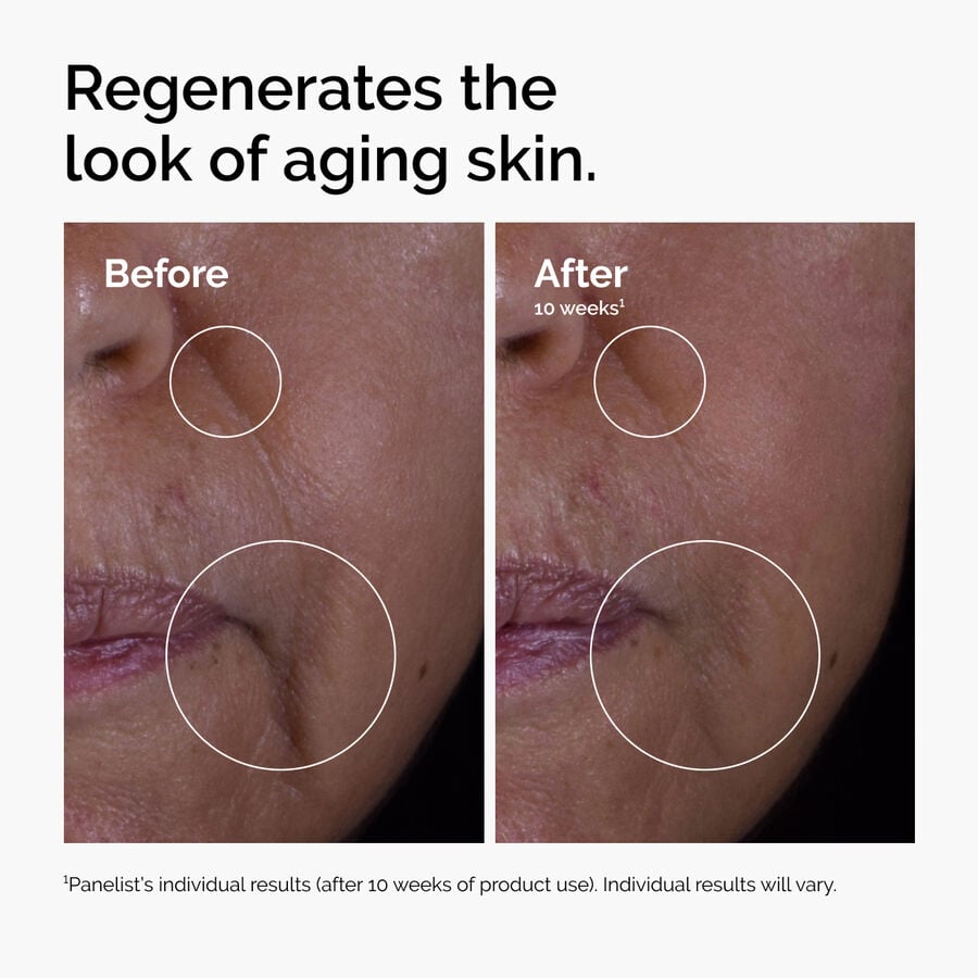 Age-Support Growth Factor Serum, GF 15% Solution