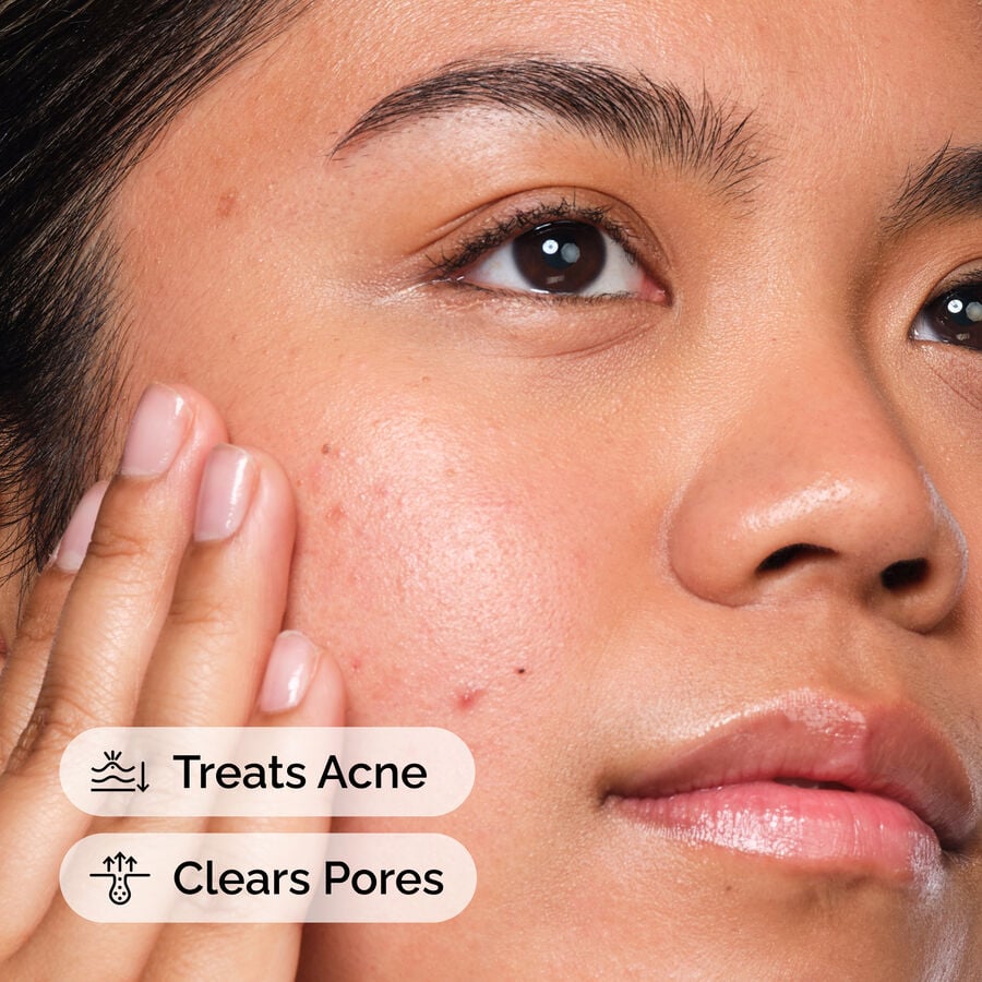 Salicylic Acid 2% Facial Serum
