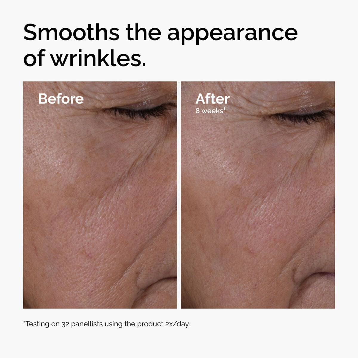 Multi-Peptide and HA Age-Support Serum