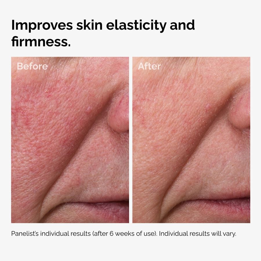 100% Fermented Rose Hip Seed Oil for Sensitive-Looking Skin