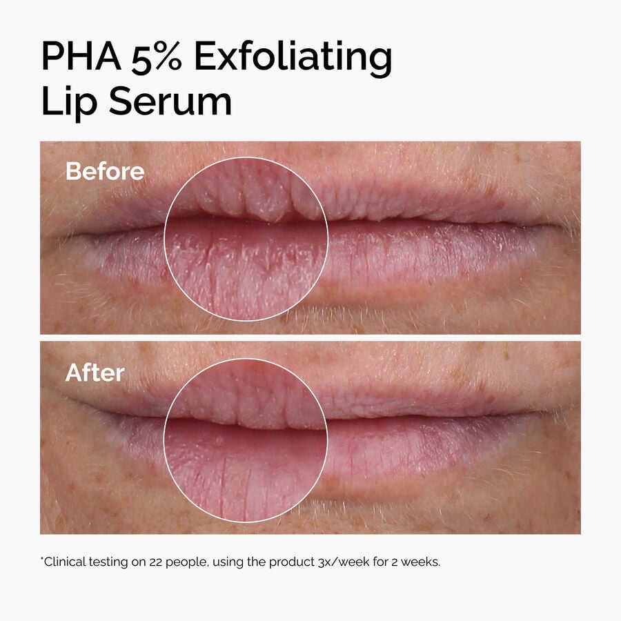 PHA 5% Gentle Exfoliating Lip Serum