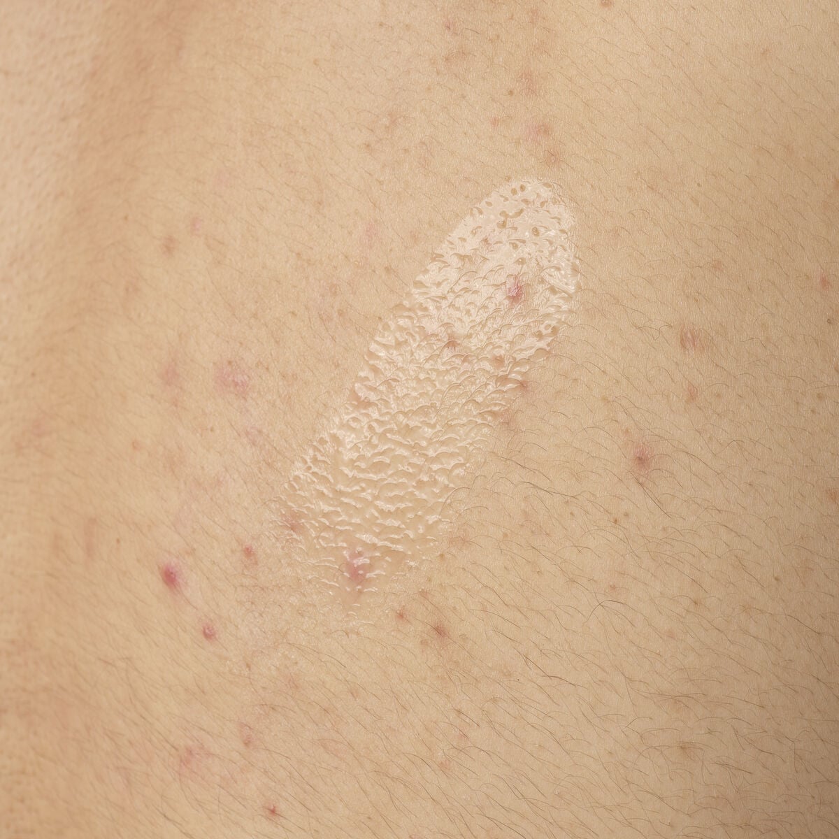 Salicylic Acid 0.5% Exfoliating Body Serum