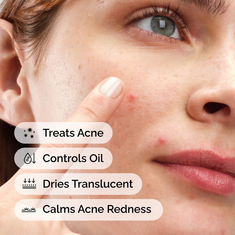 Sulfur 10% Powder-to-Cream Acne Concentrate